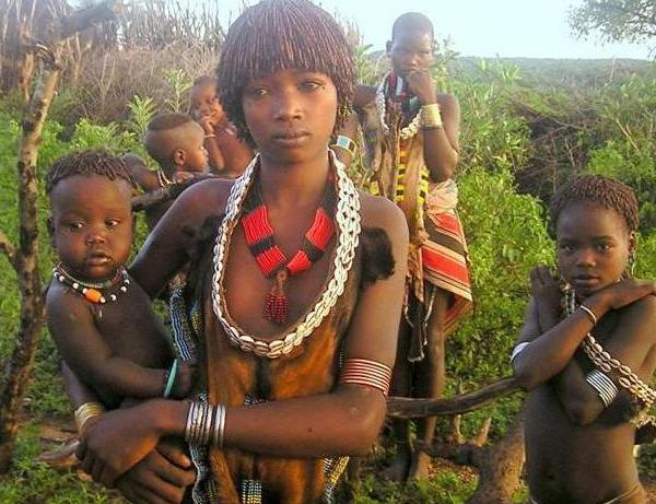 奇闻异事非洲象人族的女人照片